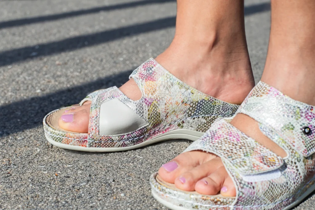 Haluksy dotykają nawet 23% kobiet. Czy odpowiednie obuwie może zatrzymać deformację?