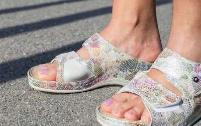 Haluksy dotykają nawet 23% kobiet. Czy odpowiednie obuwie może zatrzymać deformację?